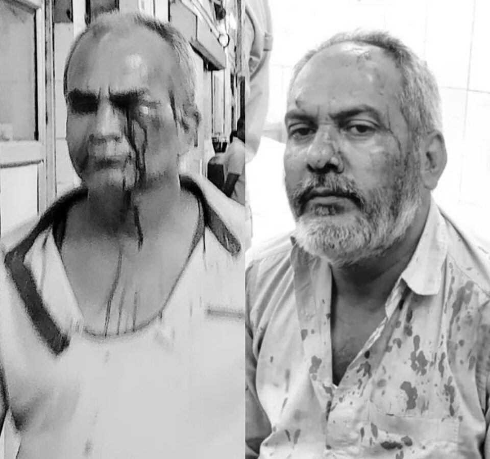 Jamshedpur News : जमशेदपुर मानगो बस स्टैंड पर शिव शक्ति बस के मैनेजर और शिव महिमा बस के ड्राइवर व साथियों के बीच जमकर मारपीट, दोनों तरफ से दो घायल….