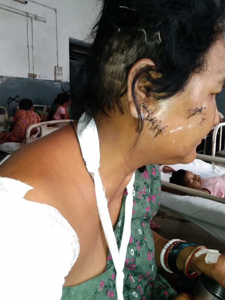 सरायकेला : डायन के आरोप में महिला को कुल्हाड़ी से मारकर किया घायल…