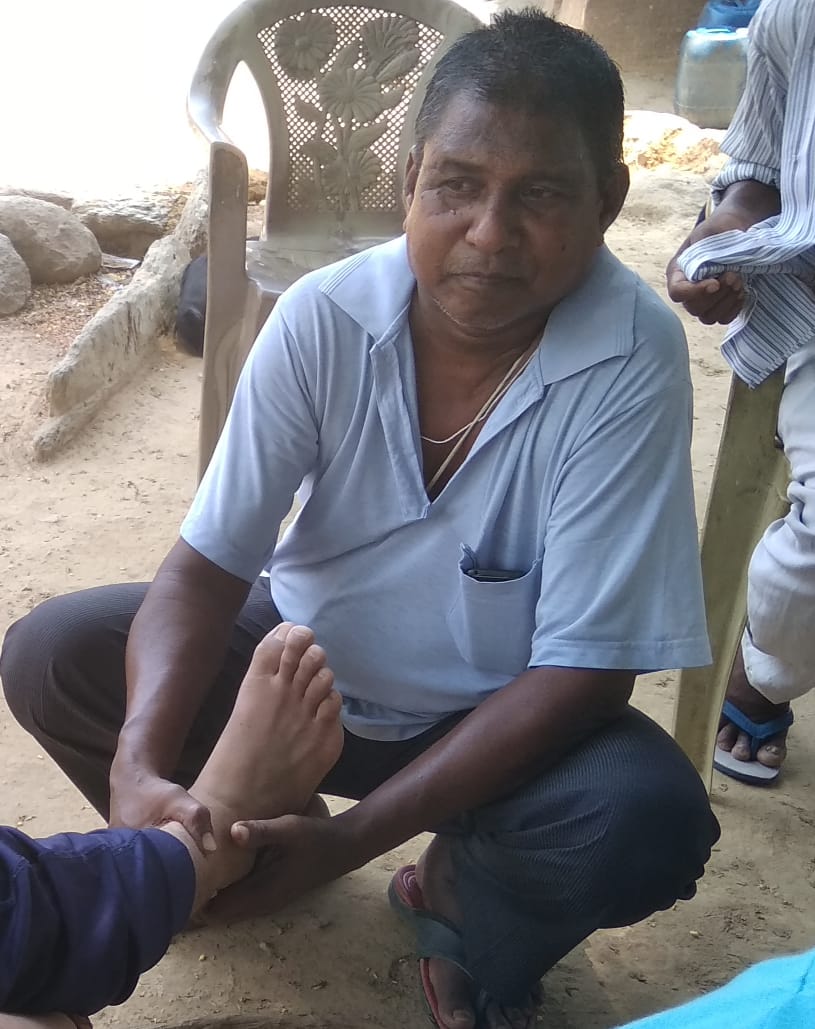सरायकेला : मात्र एक अगरबत्ती और ₹11 के सहयोग पर हड्डियों की मोच और टूटी हड्डियों को जोड़ने का करते थे शर्तिया इलाज…