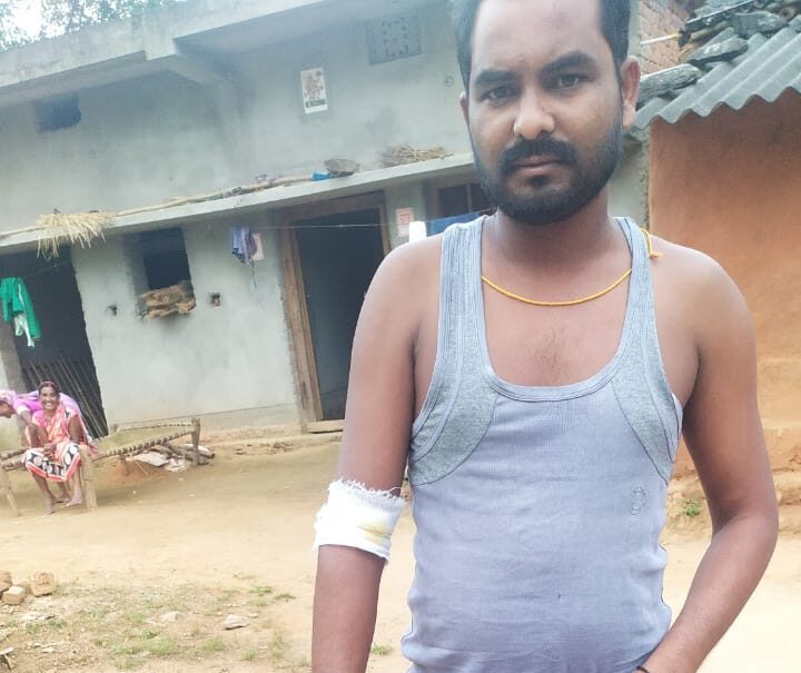 ईचागढ़ प्रखंड में जंगली जानवरों का आतंक 5 ग्रामीणों को सियार ने काटा, गांव में दहशत का माहौल… – Vananchal 24TV Live – वनांचल 24TV लाइव